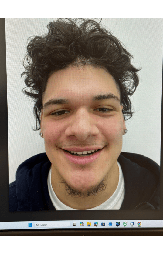 After treatment — crowding case, 9 months